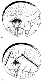 bk_4_3_1.jpg (17785 bytes)