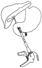bk_4_3_2.jpg (11369 bytes)