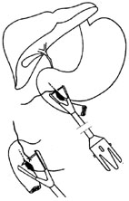 bk_4_3_3.jpg (13570 bytes)