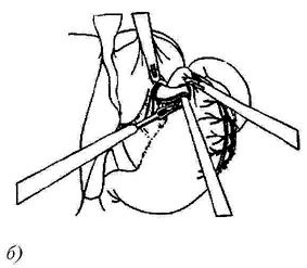 bk_4_3_42.jpg (20290 bytes)