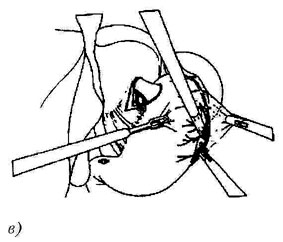bk_4_3_43.jpg (20707 bytes)