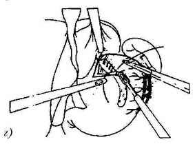 bk_4_3_44.jpg (20777 bytes)