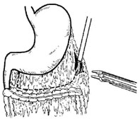 bk_5_3.jpg (14396 bytes)