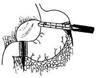 bk_5_4.jpg (13869 bytes)