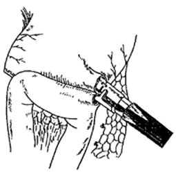 bk_5_7.jpg (18288 bytes)