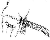 bk_5_8.jpg (11531 bytes)